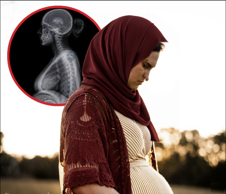 Pregnancy Can Temporarily Reshape a Mother’s Brain